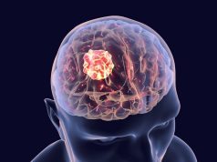 Neuroleadership