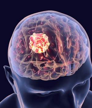 Neuroleadership Neuroleadership